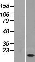 NDUF3 (NDUFAF3) Human Over-expression Lysates NM_199069