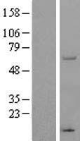 THUMPD3 Human Over-expression Lysates NM_015453