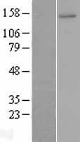 ZNF521 Human Over-expression Lysates NM_015461