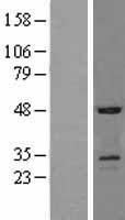 SOSTDC1 Human Over-expression Lysates NM_015464