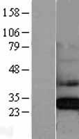 CLIC4 Human Over-expression Lysates NM_013943
