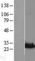 NIPSNAP3A Human Over-expression Lysates NM_015469