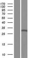 NSL1 Human Over-expression Lysates NM_001042549