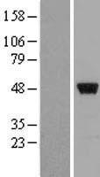 ZNF385 (ZNF385A) Human Over-expression Lysates NM_015481