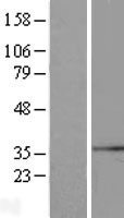 GCIP interacting protein p29 (SYF2) Human Over-expression Lysates NM_015484