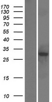 RWDD3 Human Over-expression Lysates NM_015485