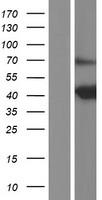 Probable hydrolase PNKD (PNKD) Human Over-expression Lysates NM_022572