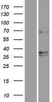 ls025963 tmem87a human over expression lysates nm 001110503 wb testing 2