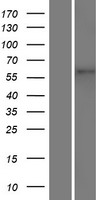 ls025963 tmem87a human over expression lysates nm 015497 wb testing 1