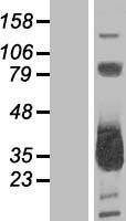 MMACHC Human Over-expression Lysates NM_015506