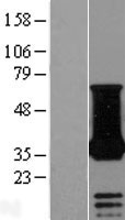 NECAP1 Human Over-expression Lysates NM_015509