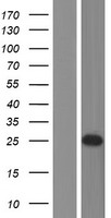 CHMP2B Human Over-expression Lysates NM_014043