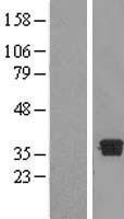 DHRS7B Human Over-expression Lysates NM_015510