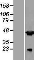 C20orf4 (AAR2) Human Over-expression Lysates NM_015511