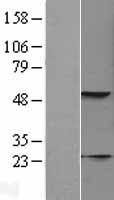KRT23 Human Over-expression Lysates NM_015515