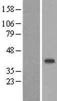ls025987 tsukushin tsku human over expression lysates nm 015516 wb testing 1