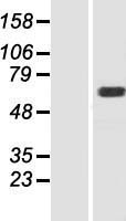 MOXD1 Human Over-expression Lysates NM_015529