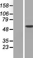 DAK (TKFC) Human Over-expression Lysates NM_015533