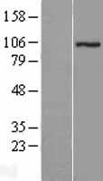 ls026009 zzz3 human over expression lysates nm 015534 wb testing 1