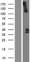 LRIG1 Human Over-expression Lysates NM_015541