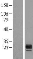 TMEM98 Human Over-expression Lysates NM_015544