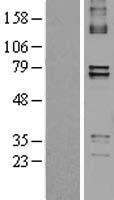 ls026024 ptcd1 human over expression lysates nm 015545 wb testing 1