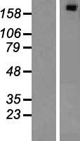 ls026037 sipa1l1 human over expression lysates nm 015556 wb testing 1