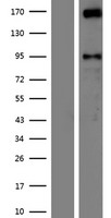 AUTS2 Human Over-expression Lysates NM_001127231