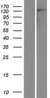 AUTS2 Human Over-expression Lysates NM_015570