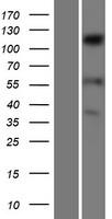 SENP6 Human Over-expression Lysates NM_015571