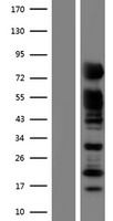 RAB11FIP5 Human Over-expression Lysates NM_015470