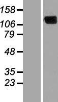 ERC2 Human Over-expression Lysates NM_015576