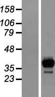 ls026061 2 hydroxy phytanoyl coa lyase hacl1 human over expression lysates nm 012260 wb testing 1