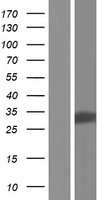 DECR2 Human Over-expression Lysates NM_020664