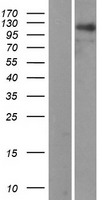 RAI14 Human Over-expression Lysates NM_015577