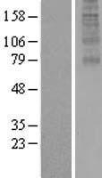 RTL8A Human Over-expression Lysates NM_001078172