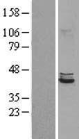 POLDIP2 Human Over-expression Lysates NM_015584