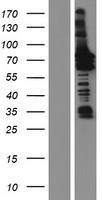 ls026088 gga1 human over expression lysates nm 001172688 wb testing 3