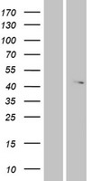 ls026090 abhd12 human over expression lysates nm 001042472 wb testing 1