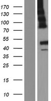 ls026090 abhd12 human over expression lysates nm 015600 wb testing 2