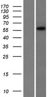 CCDC9 Human Over-expression Lysates NM_015603