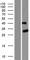 PTPN20B (PTPN20) Human Over-expression Lysates NM_001042363