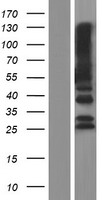 PTPN20B (PTPN20) Human Over-expression Lysates NM_015605