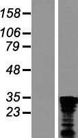 C1orf77 (CHTOP) Human Over-expression Lysates NM_015607