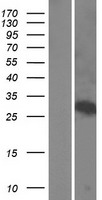 WSB1 Human Over-expression Lysates NM_134265