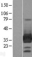ls026119 arh ldlrap1 human over expression lysates nm 015627 wb testing 1