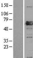 PRPF31 Human Over-expression Lysates NM_015629