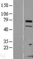TCTN3 Human Over-expression Lysates NM_001013840