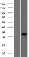 FGFR1OP2 Human Over-expression Lysates NM_015633