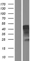 SERBP1 Human Over-expression Lysates NM_001018067